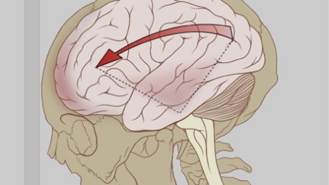 Using your head: the dangers of concussions and brain injuries