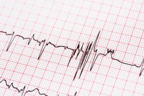 Mass Heartbeat conducts heart screenings for students
